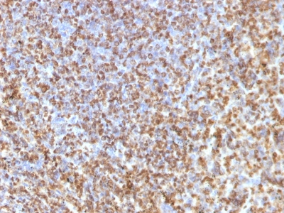 FFPE human spleen sections stained with 100 ul anti-Galectin-13 (clone PP13/1161) at 1:100. HIER epitope retrieval prior to staining was performed in 10mM Citrate, pH 6.0 or 10mM Tris 1mM EDTA, pH 9.0.